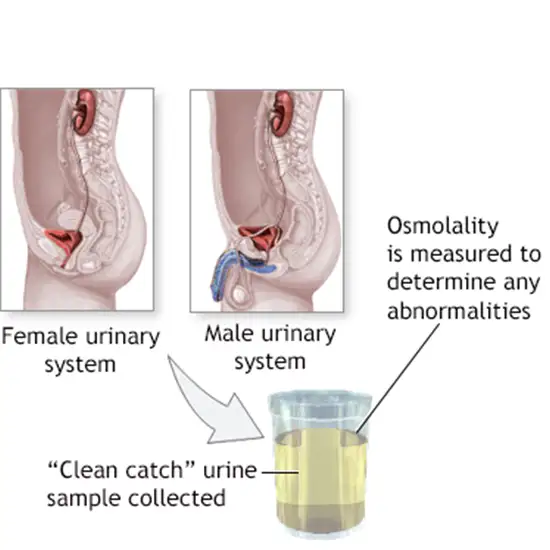 urine osmolality